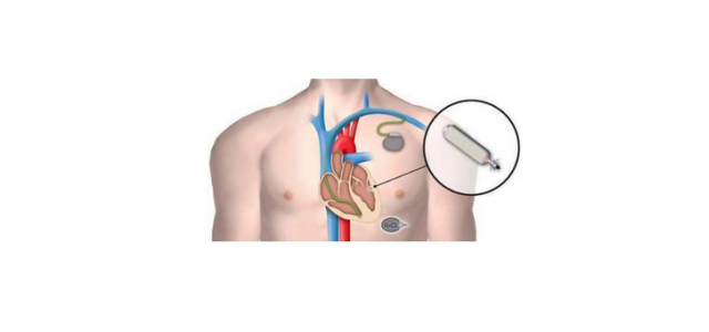 世界三大心臟起搏器品牌